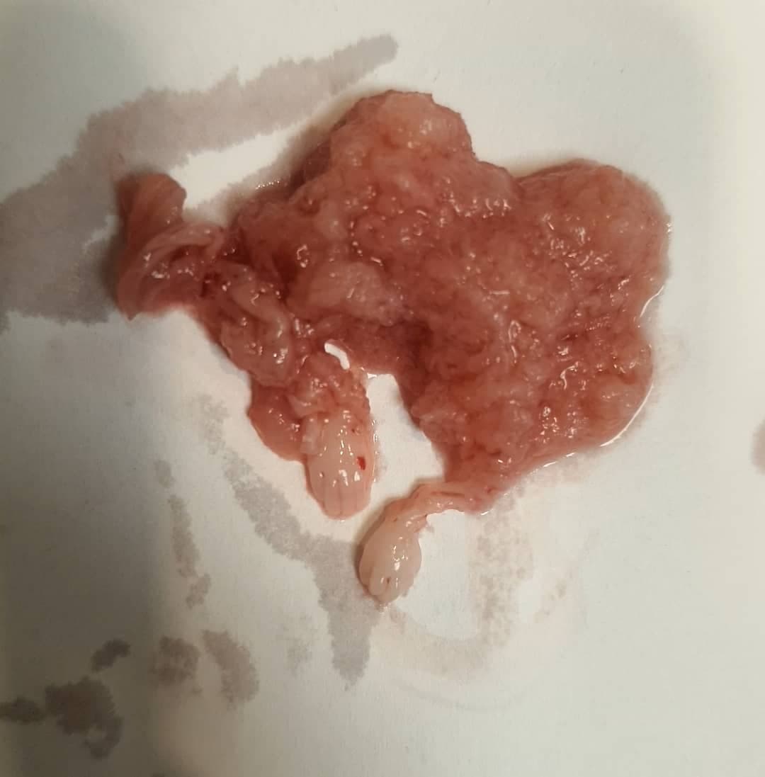 These very tiny hands/feet-to-be..
P.S. D&C specimen